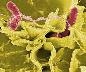 Color-enhanced scanning electron micrograph of red Salmonella typhimurium in yellow human cells